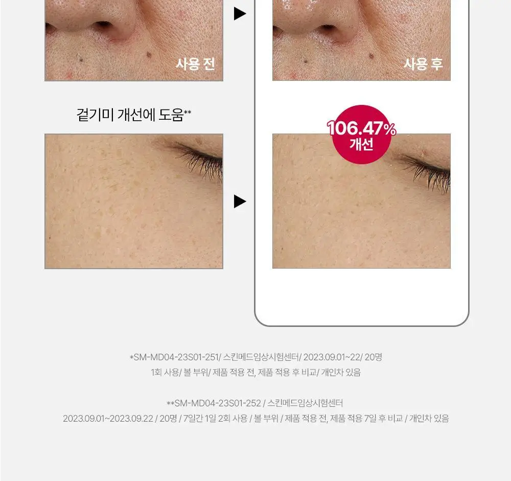 [윤곽앰플] 메디톡스 뉴라덤 코어타임 앰플 15ml [기획(+7ml)/단품] 상세페이지 34